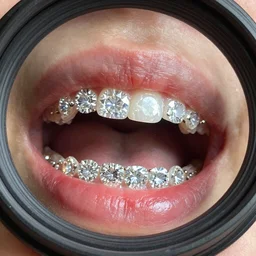 close up fisheye lens vvs Diamond grills in a mouth full of blood, grills made by Johnny Dang in Houston