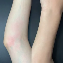 both left and right hands wrists, subsurface scattering photo